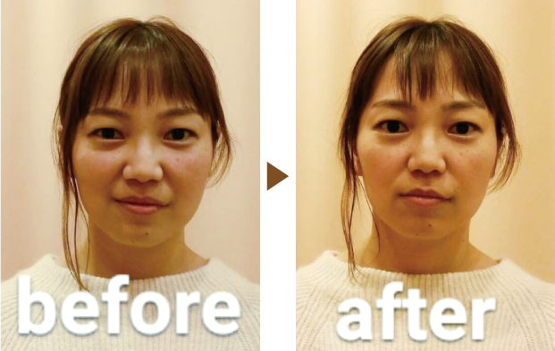 ビフォーアフター写真
